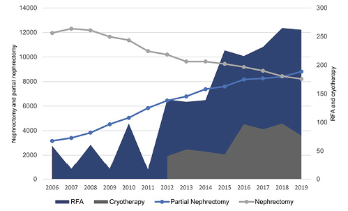 Overview of trends for RCC treatment from 2006 to 2019 (source: Destatis data). Refer to the image caption for details.