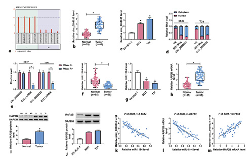  Circ_0008035, miR-1184 and RAP2B expression in BC. a Circ_0008035 was highly expressed in tumor (T) as compared to adjacent normal tissues (N) in GSE92675. b Circ_0008035 abundance in 55 paired BC tumor tissues and adjacent normal tissues was examined by qRT-PCR. c Circ_0008035 level was detected using qRT-PCR in BC cells (5,637 and T24) and human ureteral epithelial cells (SV-HUC-1). d The nuclear and cytoplasm separation experiment was employed to explore the location of circ_0008035 in BC cells. e The levels of circ_0008035 and its linear transcript EXT1 mRNA in BC cells with or without RNase R treatment were measured by qRT-PCR. f, g MiR-1184 expression was detected by qRT-PCR in BC tissues (n= 55) and cells. h–j RAP2B mRNA and protein levels in BC tissues (n= 55) or cells were examined using qRT-PCR or Western blotting. k–m Correlation among the levels of circ_0008035, miR-1184, and RAP2B in 50 cases of BC tissues. *p< 0.05.