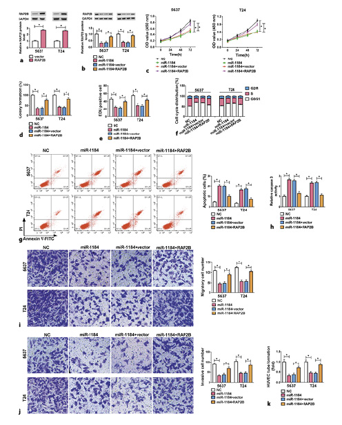 RAP2B mediates the functions of miR-1184 in BC progression. a The protein level of RAP2B was detected using Western blotting in cells transfected with vector or RAP2B overexpression vector. b–k 5,637 and T24 cells were transfected with NC, miR-1184 mimic, miR-1184 mimic + vector, or miR-1184 mimic + RAP2B overexpression vector, respectively. Western blotting, CCK-8, colony formation, Edu staining, flow cytometry, caspase-3 assay kit, transwell, and tube formation assays were conducted to evaluate the protein level of RAP2B (b), cell proliferation (c–e), cell cycle progression (f), apoptosis (g), caspase-3 activity (h), migration (i), invasion (j), and angiogenesis (k) in transfected cells. *p< 0.05. CCK-8, Cell Counting Kit-8. Refer to the image caption for details.