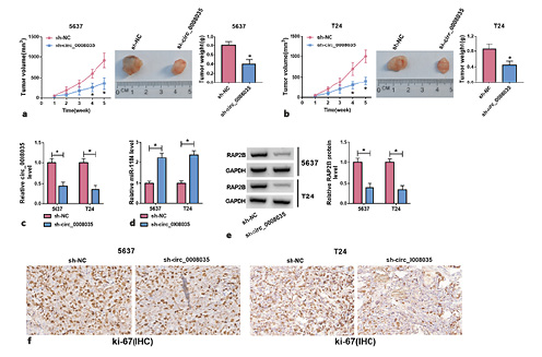  Circ_0008035 silencing inhibits BC tumor growth in vivo. 5,637 and T24 cells stable transfected with sh-circ_0008035 or sh-NC were injected into the nude mice to establish a xenograft model (5 mice for each group). Five weeks upon injection, (a, b) tumor volume and weight, (c–e) as well as circ_0008035, miR-1184 and RAP2B levels in xenograft tumor tissues were measured. f IHC staining for ki-67 was employed to evaluate the proliferation of tumor cells in xenograft tumor tissues. *p< 0.05.