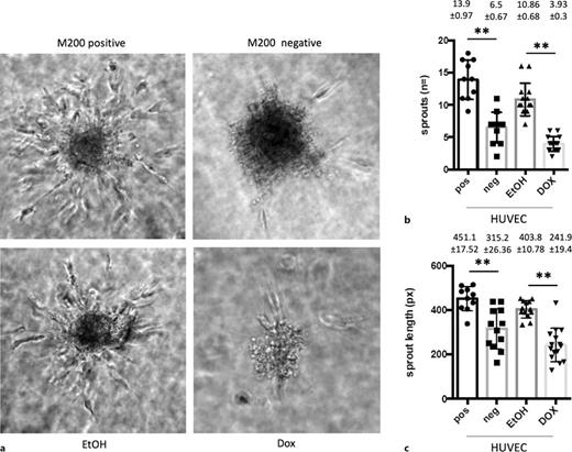 Number and average length of sprouts from HUVEC cells treated with the supernatant of miR-205-overexpressing ccRCC cells (Tet-On). a As illustrated by microscopic images (××40 magnification), doxycycline induction (i.e., miR-205 overexpression) compared to EtOH administration was associated with less (b) and shorter vessel sprouts – measured in pixel length by ImageJ (c). Presence and absence of recombinant VEGF within M200 medium served as positive and negative control. **p < 0.01. Method: cells treated with either EtOH or DOX were cultured overnight in hanging drops → incubated for 24 h → spheroids fixed and washed → pictures taken.