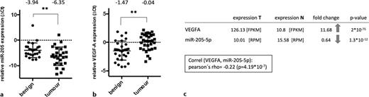 miR-205 and VEGFA expression in RCC. a miR-205 is significantly downregulated in malignant tissue of an in-house RCC cohort. bVEGFA is significantly upregulated in cancerous lesions. c Data from the TCGA ccRCC cohort: VEGFA is significantly overexpressed in malignant tissue (n = 523) compared to benign tissue (n = 100). Apart from VEGFA upregulation, miR-205 is significantly downregulated in ccRCC specimens – resulting in a significant negative correlation of VEGFA and miR-205 expression. FPKM, fragments per kilobase per million mapped reads; RPM, reads per million mapped reads. Refer to the image caption for details.