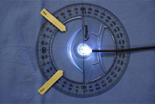 Measuring the visual field. Refer to the image caption for details.