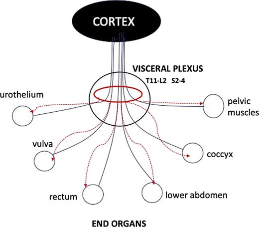 General hypothesis role of the Axon reflex in female chronic pelvic pain. The black lines to the cortex represent afferent visceral nerves which enter the visceral plexuses (VPs) and proceed onwards to a ganglion. The VPs are supported by the lower end of the uterosacral ligaments (USLs), about 2 cm before the USLs insert into the cervix. The red ellipse shows the bunching of the afferent axons in the VPs. In the standing position, each of the component axons in the unsupported VPs (unbroken lines) is stimulated by the force of gravity and they send afferent signals to the cortex. This “bunching” in the ellipse explains the simultaneous relief of several pain centers with the speculum tests and local anesthetic injection into the USLs. Activation of the axon reflex sends antidromic impulses back to the end organ receptors which stimulate an inflammatory reaction which can cause pain.