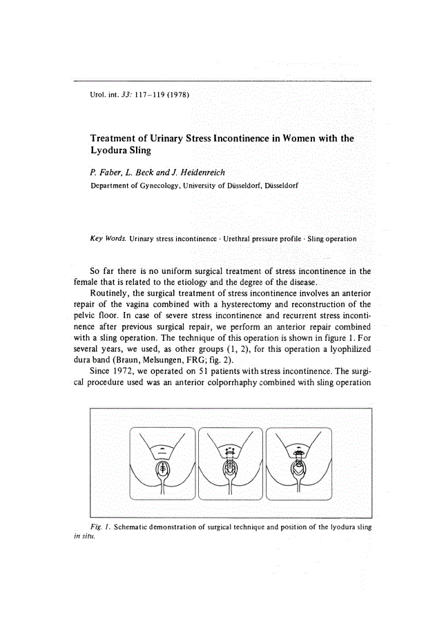 First page of Treatment of Urinary Stress Incontinence in Women with the Lyodura Sling