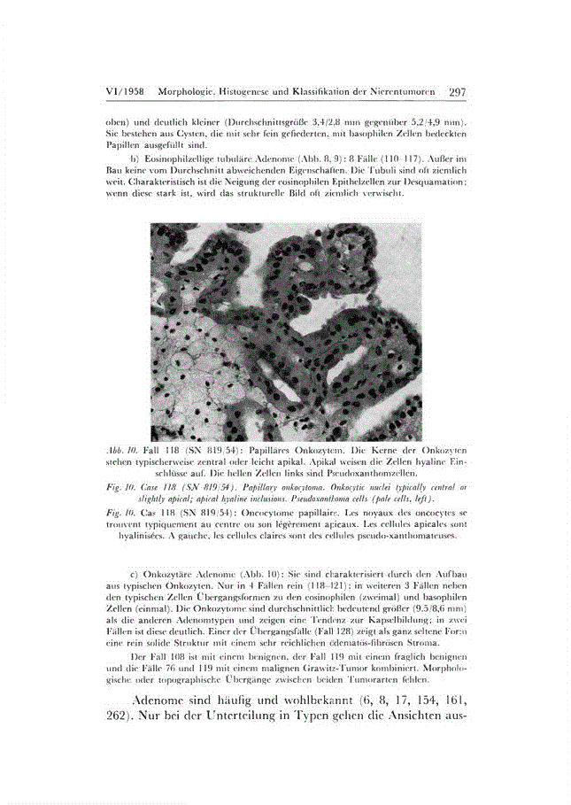 First page of Morphologie, Histogenese und Klassifikation der Nierentumoren (Part 2 of 4)