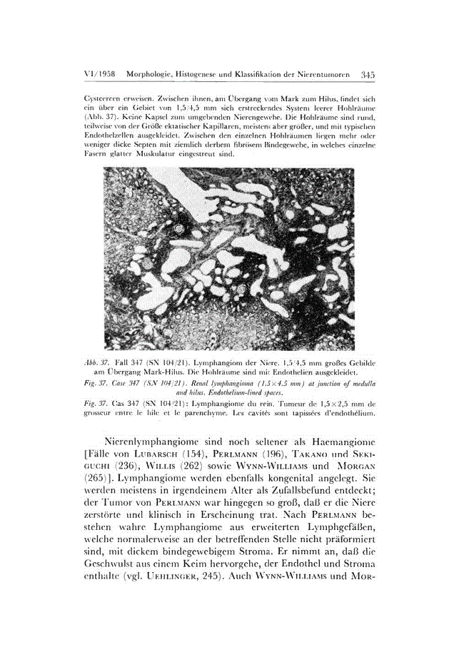 First page of Morphologie, Histogenese und Klassifikation der Nierentumoren (Part 4 of 4)