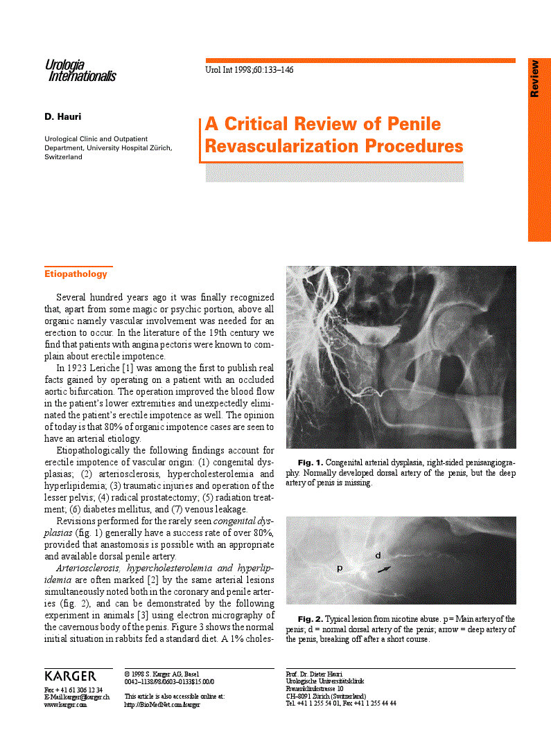 First page of A critical Review of Penile Revascularization Procedures