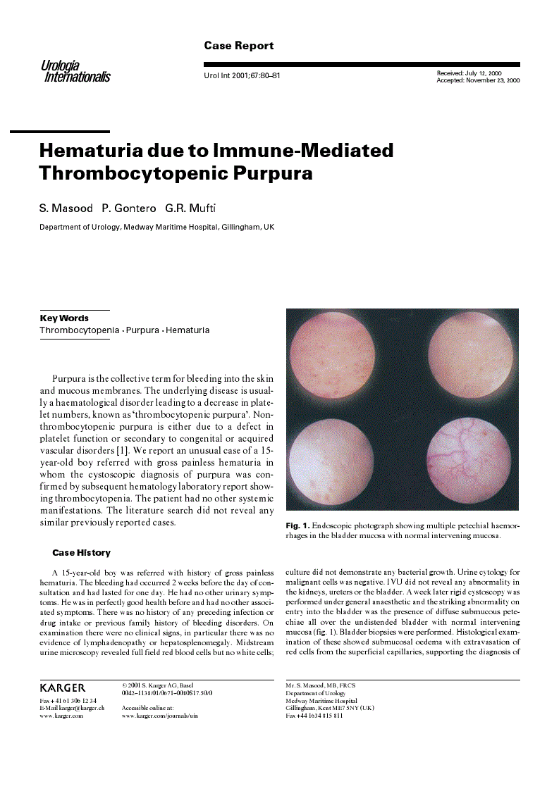 First page of Hematuria due to Immune-Mediated Thrombocytopenic Purpura