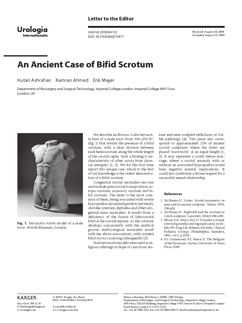 First page of An Ancient Case of Bifid Scrotum
