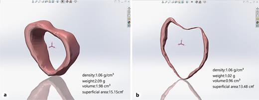 Parameters of the bulbocavernosus muscle. a Parameters of the bulbocavernosus muscle in non-POP patients. b Parameters of the bulbocavernosus muscle in POP patients. POP, pelvic organ prolapse.