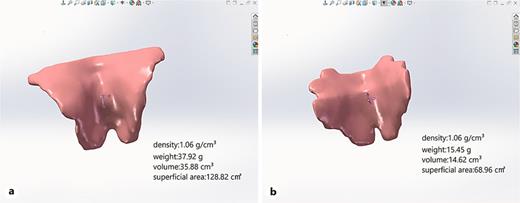 Parameters of the levator ani muscle. a Parameters of the levator ani muscle in patients with POP. b Parameters of the levator ani muscle in patients with non-POP. POP, pelvic organ prolapse.