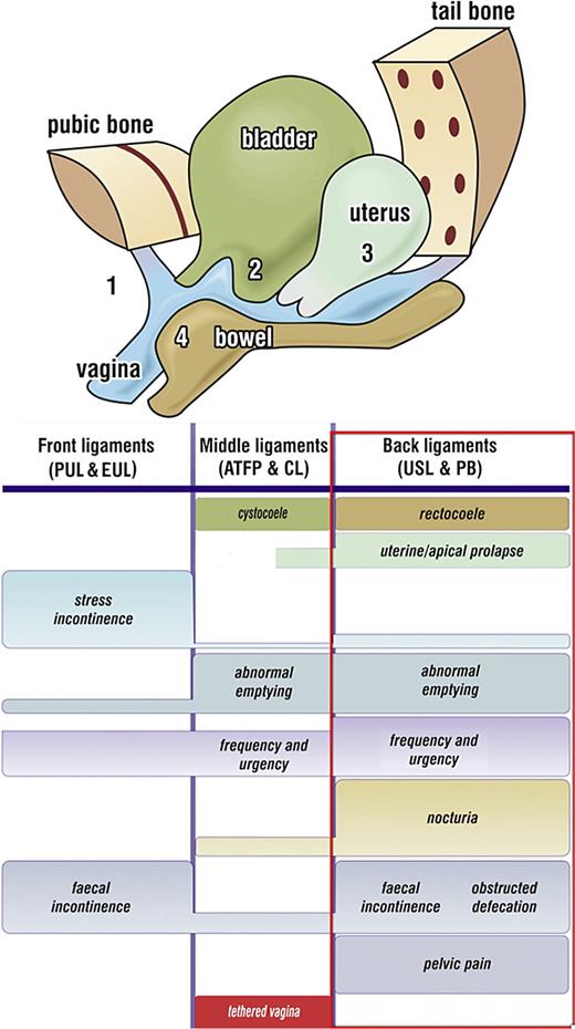 Diagnostic algorithm. The rectangle represents the co-occurring symptoms of the “Posterior Fornix syndrome.” CPP and nocturia are uniquely caused by uterosacral ligament (USL) laxity and are cured or improved by USL repair.
