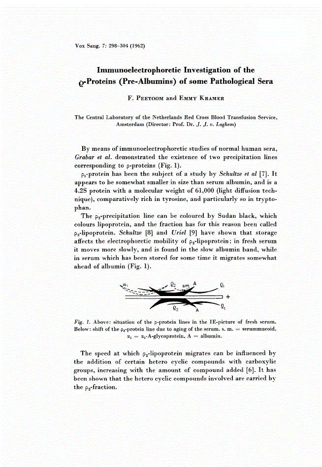 First page of Immunoelectrophoretic Investigation of theϱ-Proteins (Pre-Albumins) of some Pathological Sera